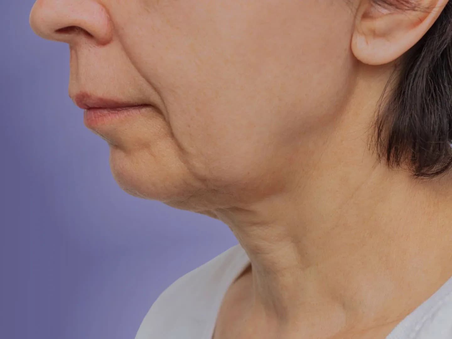 Jowls