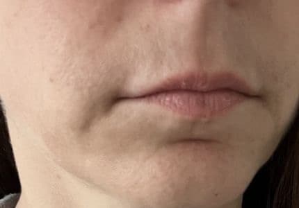 Trauriger Ausdruck